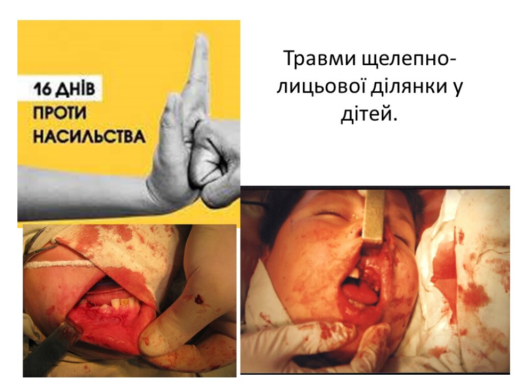 Лікарі-інтерни проти насильства в сім’ї
